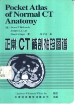 头和脑正常CT解剖袖珍图谱 中英文本