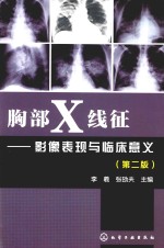 胸部X线征 影像表现与临床意义