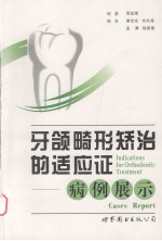 牙颌畸形矫治的适应症 病例展示