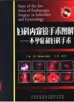 妇科内窥镜手术图解 不孕症和妇科手术