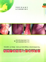 麻风病诊断与鉴别诊断图谱