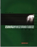 四肢骨折锁定钢板内固定手术技术