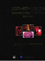 坎贝尔 沃尔什泌尿外科学 第9版 第2卷