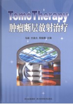 TomoTherapy肿瘤断层放射治疗