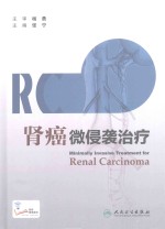 肾癌微侵袭治疗