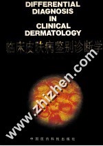 临床皮肤病鉴别诊断学