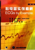 心电图实例精解 E