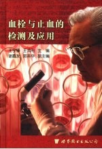 血栓与止血的检测及应用