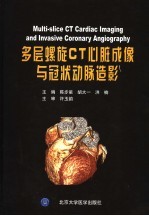 多层螺旋CT心脏成像与冠状动脉造影