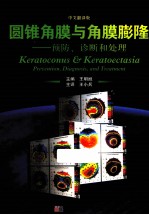 圆锥角膜与角膜膨隆 预防、诊断和处理 中文翻译版