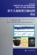 新生儿振幅整合脑电图图谱