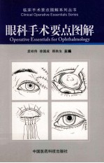 眼科手术要点图解