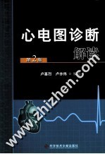 心电图诊断解读