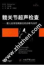 髋关节超声检查 婴儿发育性髋脱位的诊断与治疗