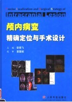 颅内病变精确定位与手术设计