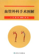 血管外科手术图解