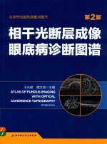 相干光断层成像眼底病诊断图谱 第2版