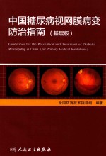 中国糖尿病视网膜病变防治指南 基层版