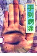 手到病除
