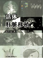 活体肝脏移植