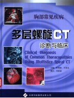 胸部常见疾病多层螺旋CT诊断与临床
