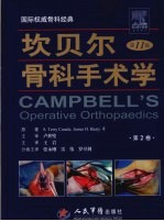 坎贝尔骨科手术学 第2卷