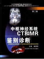 中枢神经系统CT和MR鉴别诊断 第2版