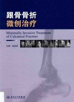 跟骨骨折微创治疗