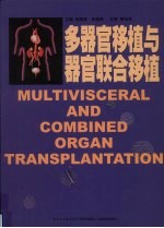 多器官移植与器官联合移植