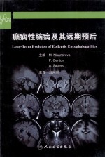 癫痫性脑病及其远期预后