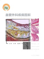 血管外科疾病图解