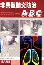 非典型肺炎防治ABC