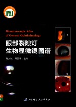 眼部裂隙灯生物显微镜图谱