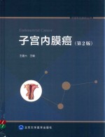 中国常见癌症丛书 子宫内膜癌 第2版