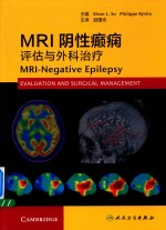 MRI阴性癫痫 评估与外科治疗 翻译版