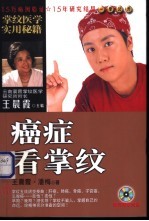 癌症看掌纹