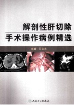 解剖性肝切除手术操作病例精选