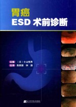 胃癌ESD术前诊断