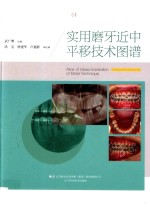 实用正畸临床系列 实用磨牙近中平移技术图谱
