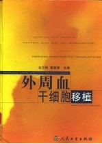 外周血干细胞移植