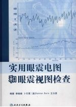 实用眼震电图和眼震视图检查