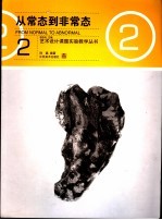 从常态到非常态