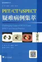 PET/CT与SPECT疑难病例集萃 临床精析病例集锦