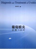葡萄膜炎诊断与治疗