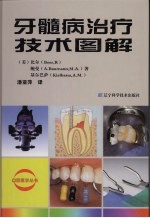 牙髓病治疗技术图解