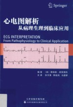 心电图解析 从病理生理到临床应用