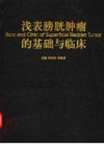 浅表膀胱肿瘤的基础与临床