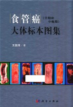 食管癌(早期和中晚期)大体标本图集