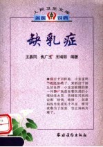 缺乳症