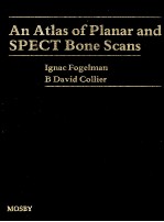 AN ATLAS OF PLANAR AND SPECT BONE SCANS